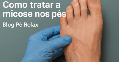 Como tratar a micose nos pés